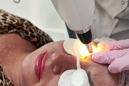 Удаление татуировок и перманентного макияжа на неодимовом лазере (Nd:YAG Q-Switch Capello, Россия)